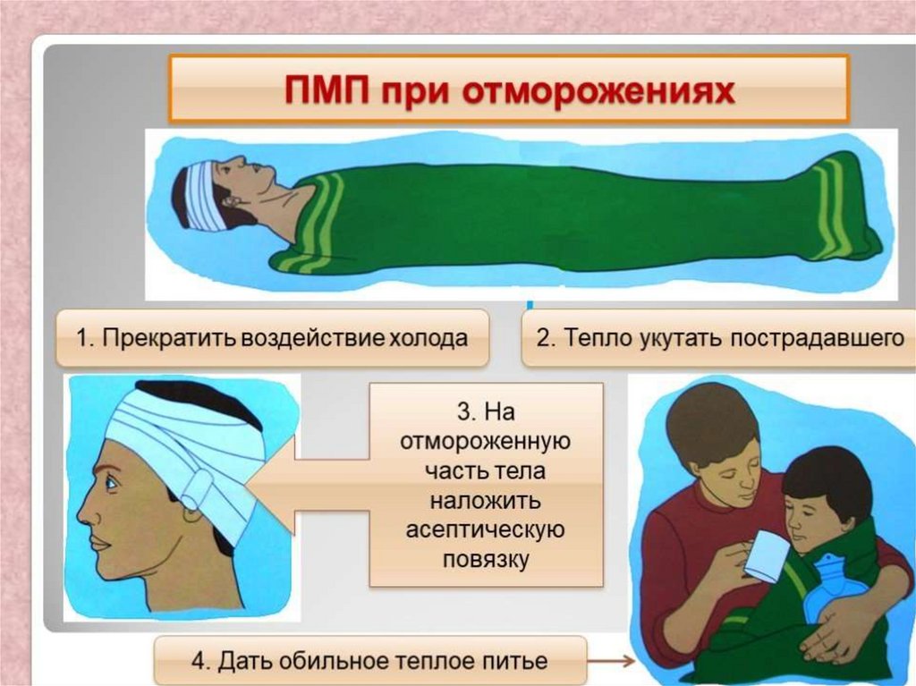 Первая медицинская помощь при обморожении презентация