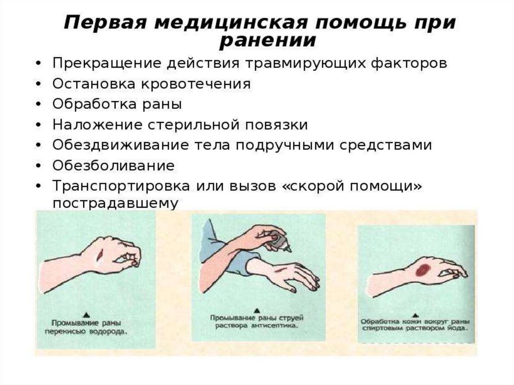 1 помощь при укушенной ране. Первая доврачебная помощь при укушенных ранах. Правила оказания помощи в случаях ранения мягких тканей. Оказание 1 медицинской помощи при резаной раны. Оказание помощи при рваных ранах.