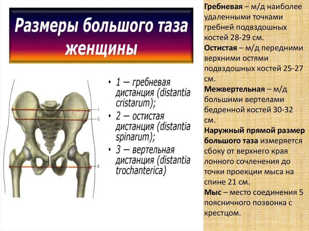 Верхняя передняя подвздошная кость