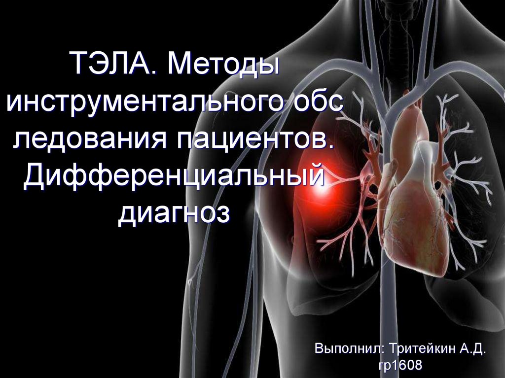 ТЭЛА. Методы инструментального обследования пациентов. Дифференциальный ...