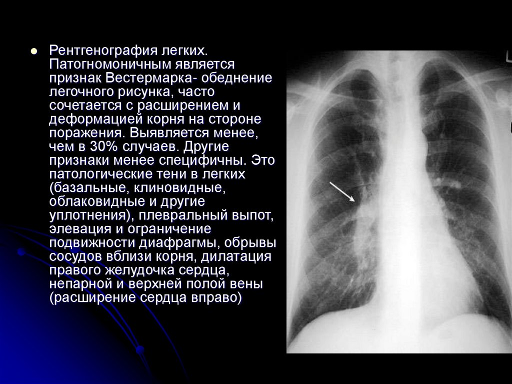 Приоритетная проблема пациента с диагнозом холера стул в виде