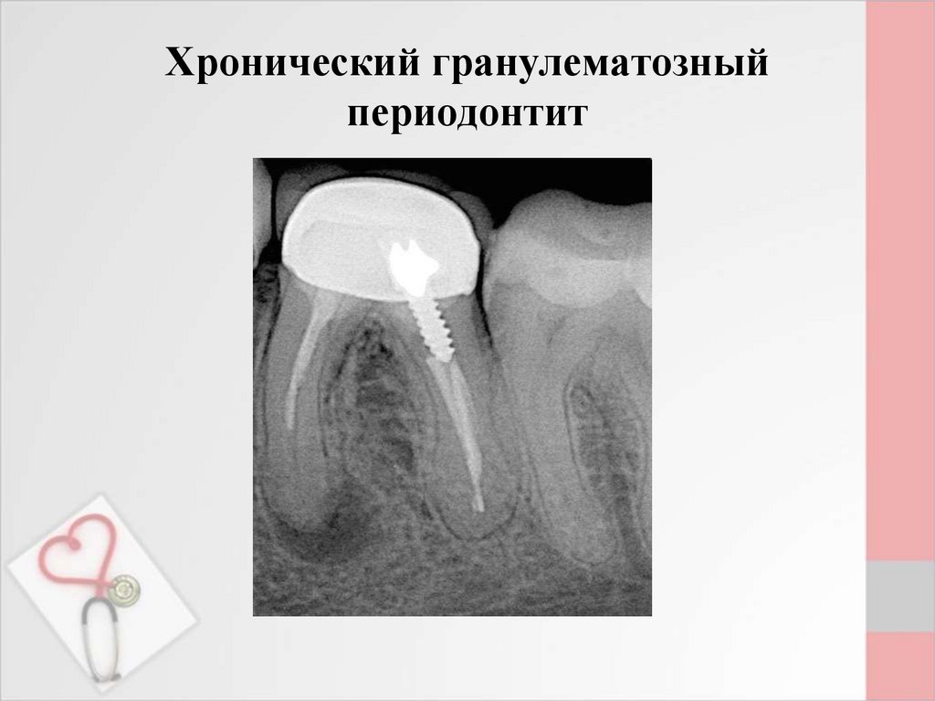 Очагово обусловленные заболевания презентация