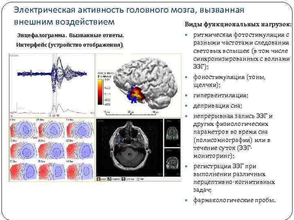Электрическая активность головного мозга
