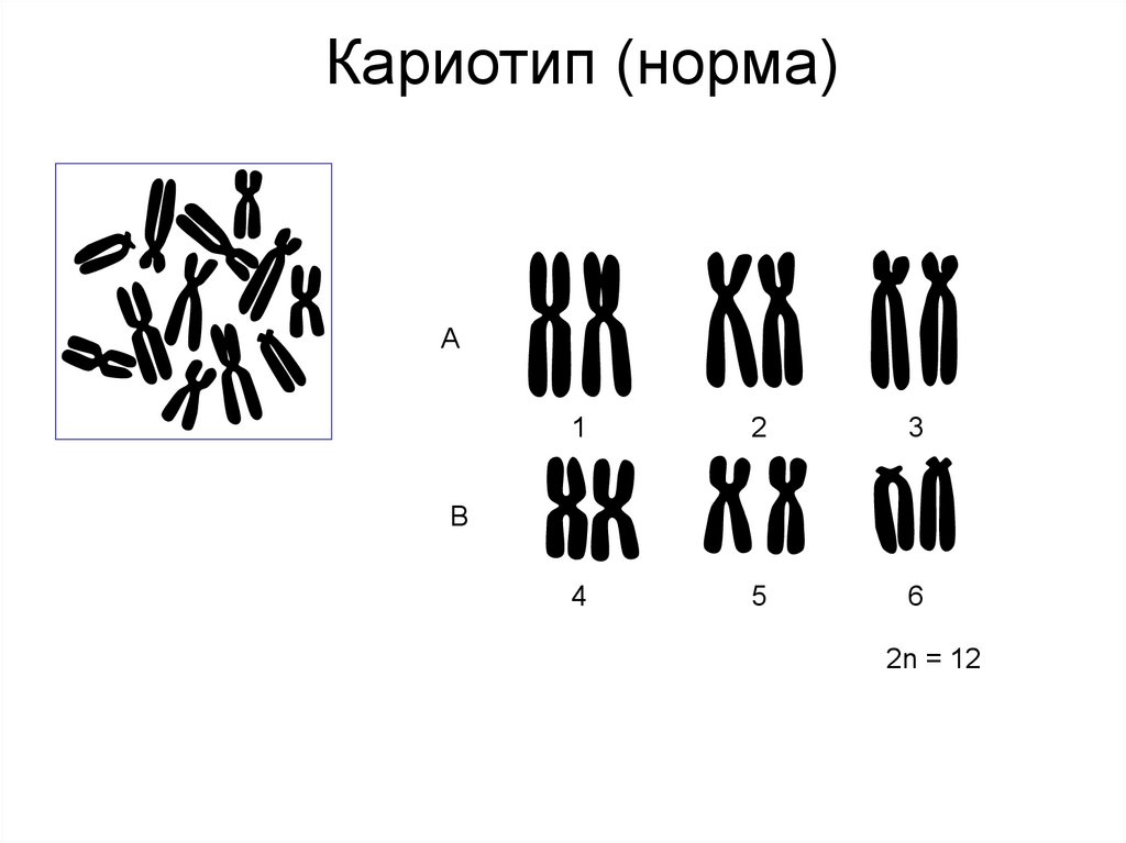 Кариотип (норма)