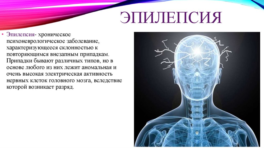 Эпилепсия нервной системы. Эпилепсия презентация. Презентация на тему эпилепсия. Профилактика эпилепсии.