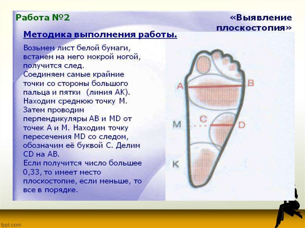 Проект на тему плоскостопие