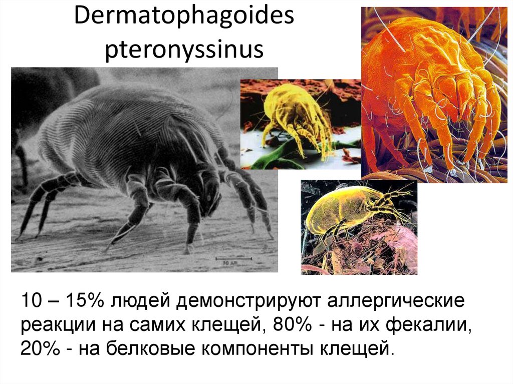 Аллергия на клещей домашней пыли. Клещ Dermatophagoides pteronyssinus IGE. Аллерген клеща Dermatophagoides pteronyssinus IGE. Клещ Dermatophagoides farinae IGE. Клещ домашней пыли Dermatophagoides farinae.