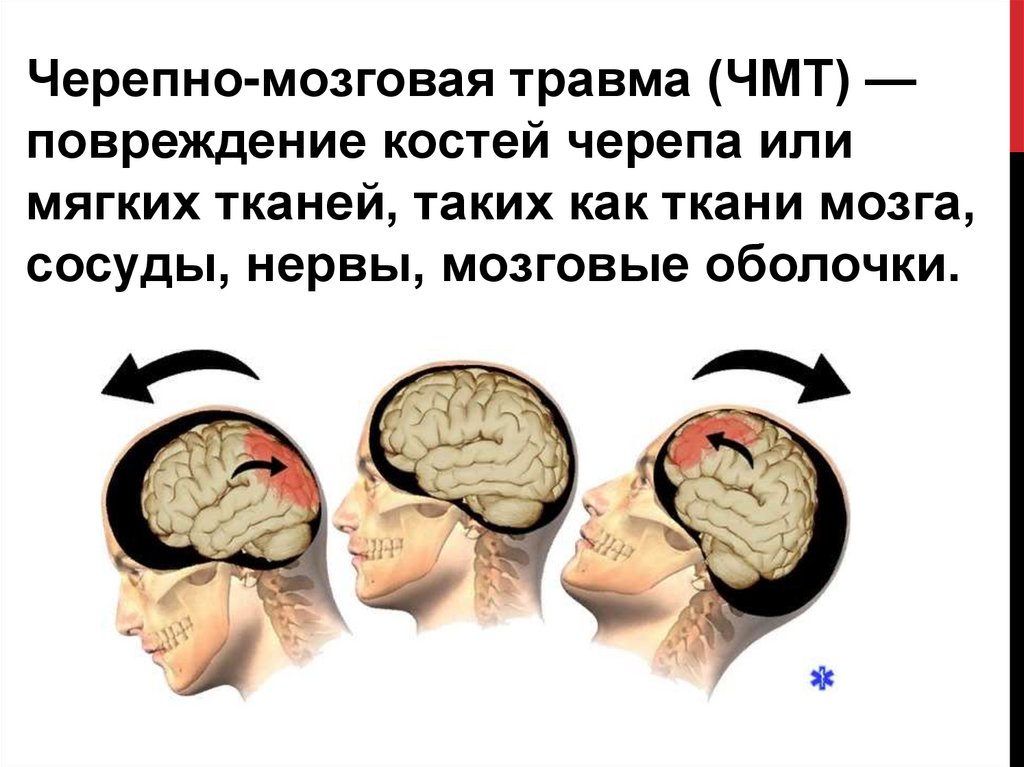 Ушиб головного мозга лечение