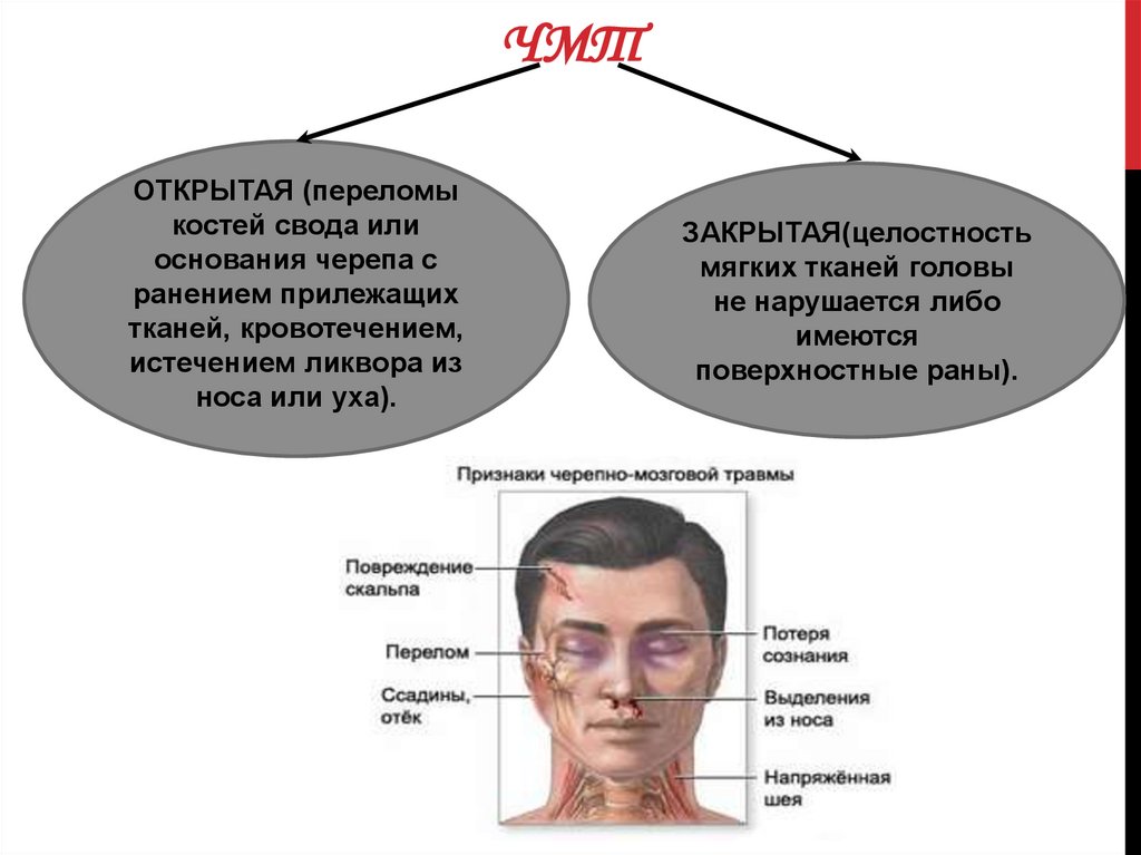 Ушиб головного мозга симптомы