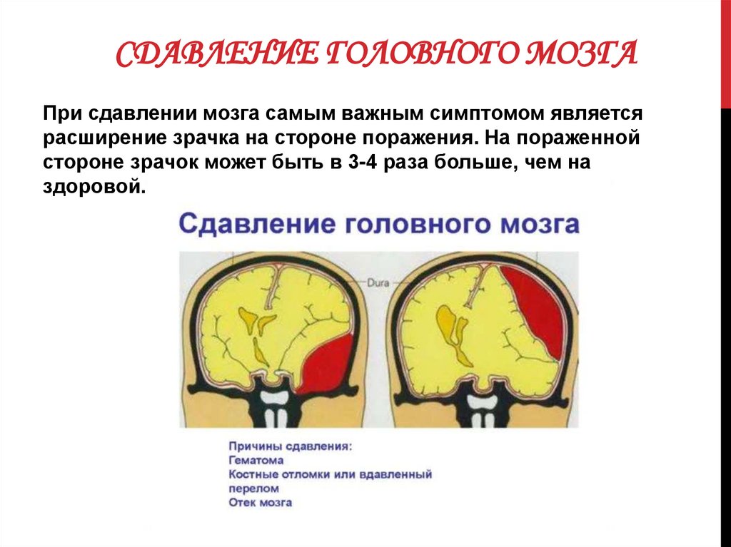 Гематома головного мозга симптомы лечение