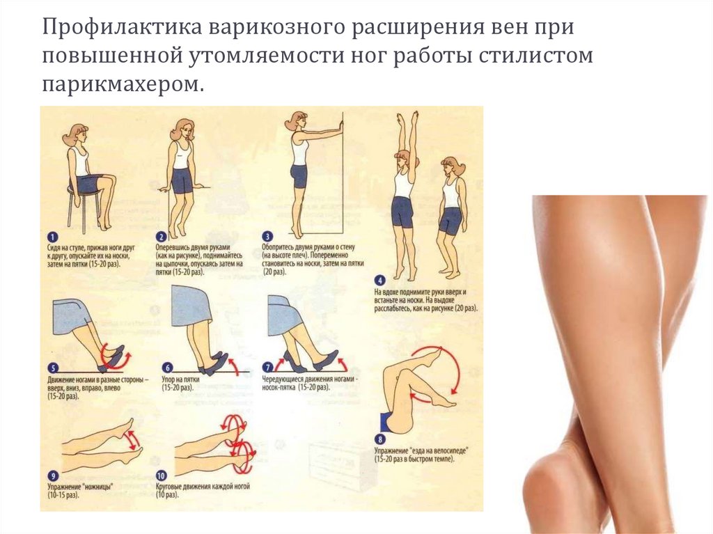 Упражнения при варикозном расширении. Профилактика варикоза на ногах. Профилактика варикозного расширения вен. Профилактика варикоза на ногах у женщин.
