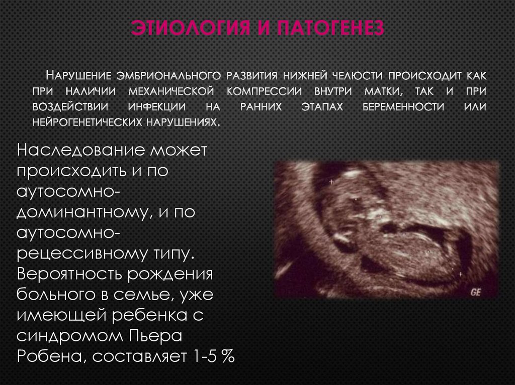 Этиология и патогенез