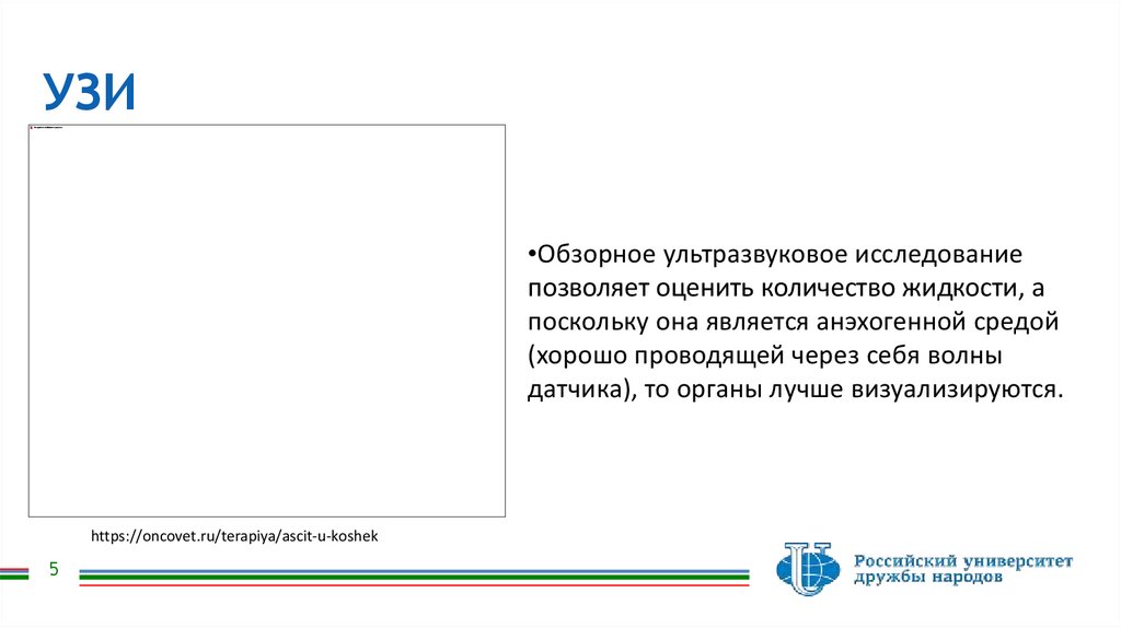УЗИ
