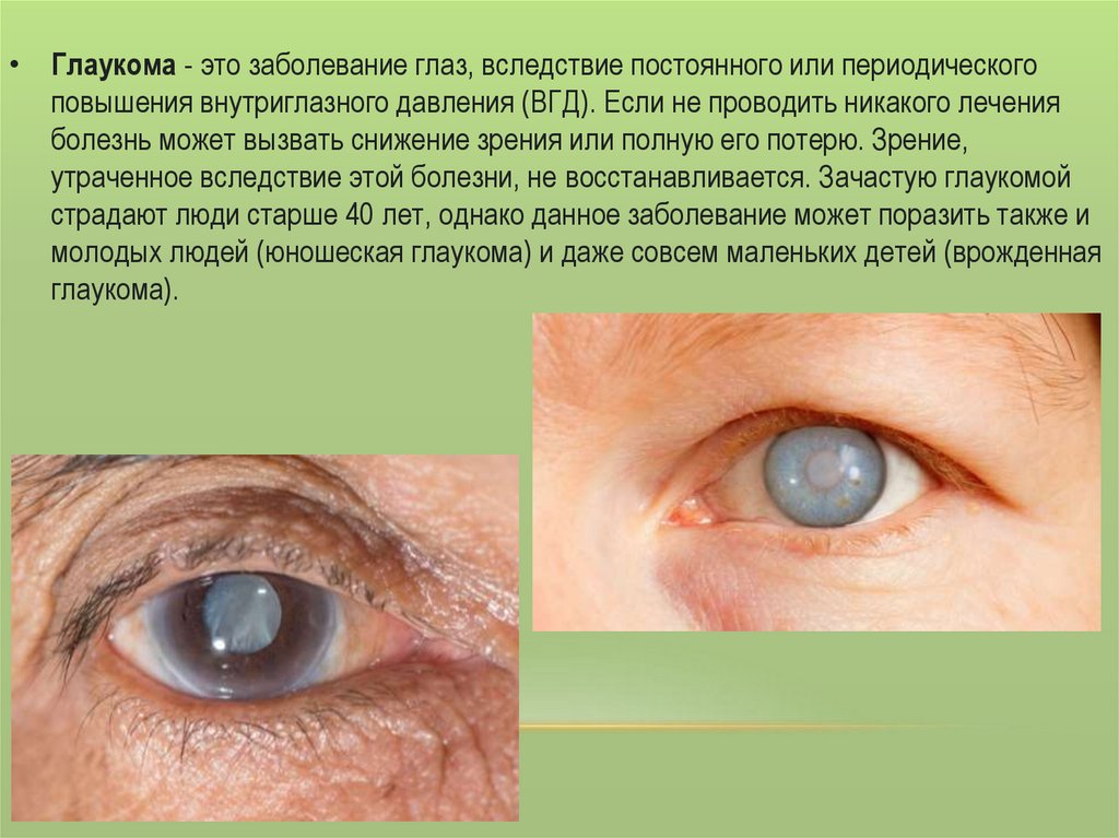 Заболеваниями заболеваний глаз появиться. Заболевание глаз глаукома. Презентация заболевания глаз. Заболевание глаз название болезней.
