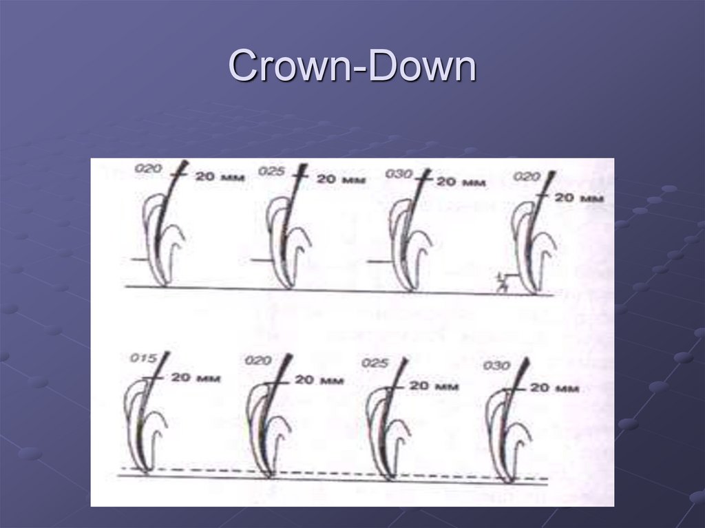 Схема crown down