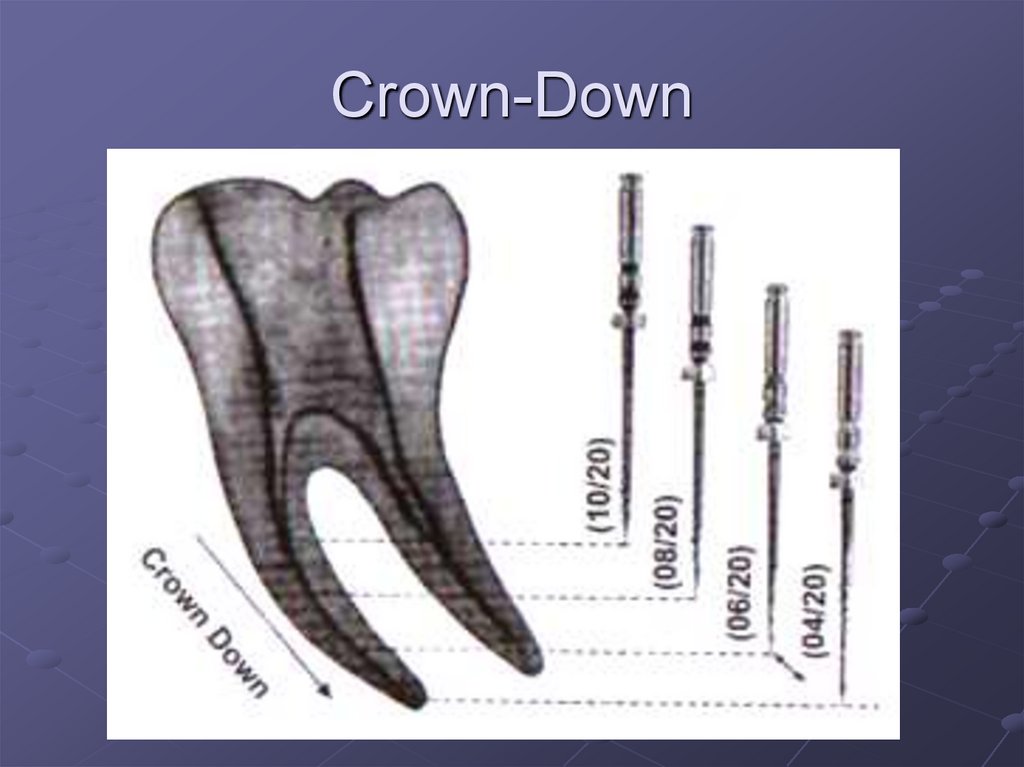 Схема crown down