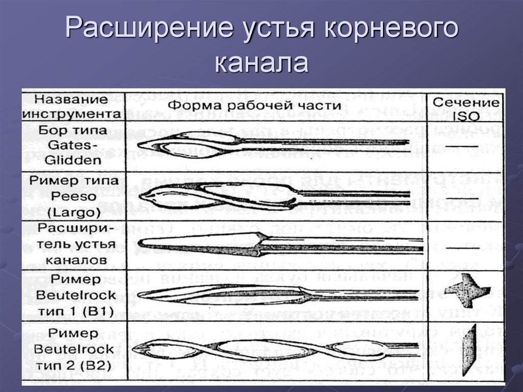 Устья корневых каналов схема