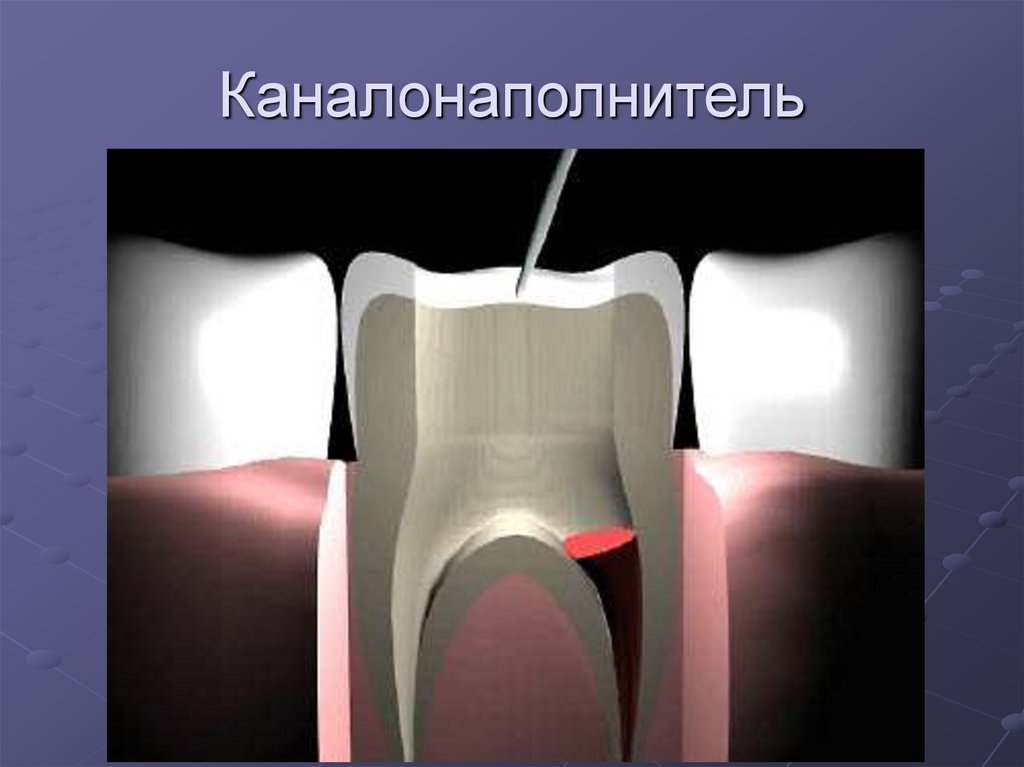 Презентации по эндодонтии