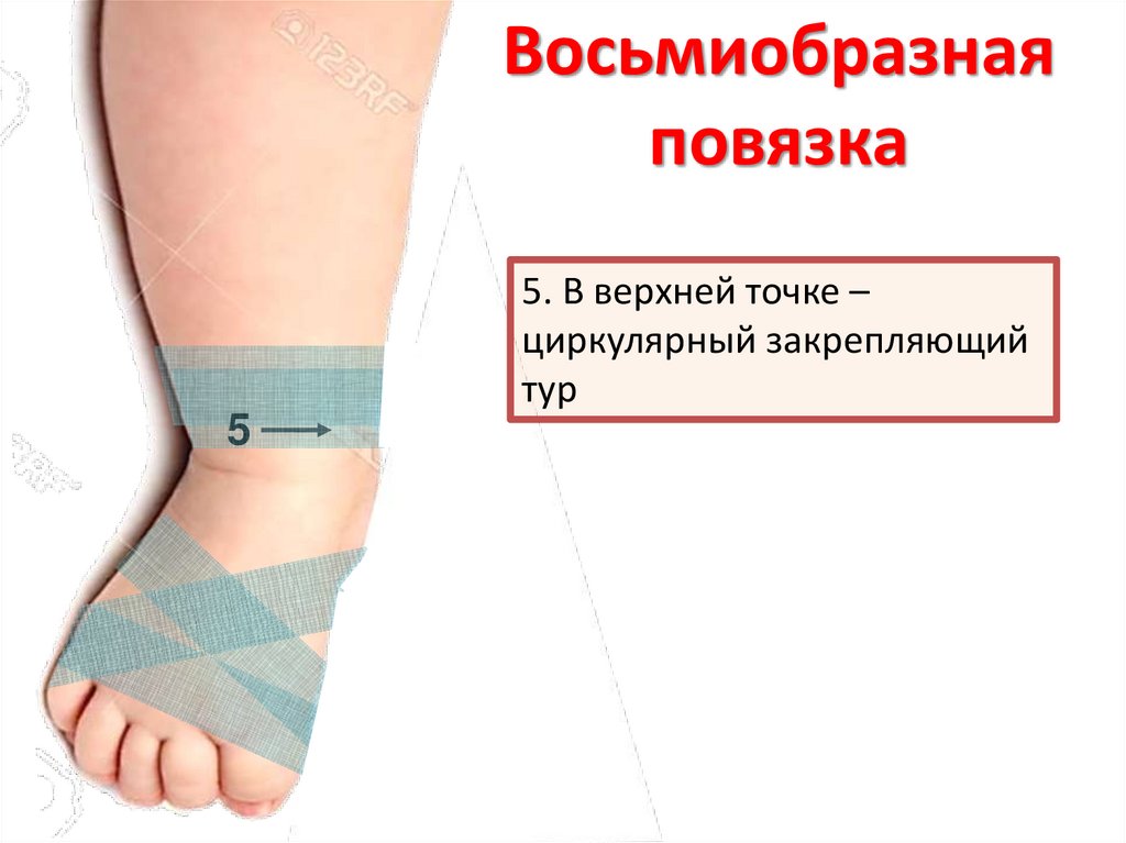 Отработка приемов по наложению крестообразной (восьмиобразной) повязки ...