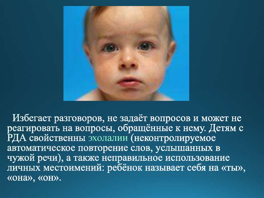 Ранний детский аутизм. Дети с синдромом раннего аутизма. Синдром раннего детского аутизма презентация. Эхолалии в детской речи.