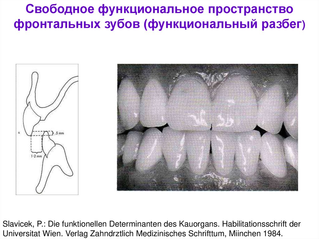 Постановка искусственных зубов презентация. Современные окклюзионные теории. Функциональное пространство в стоматологии. Схема окклюзионных контактов зубов.