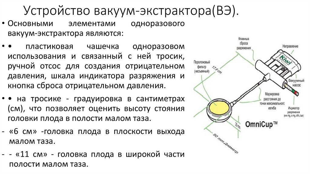 Вакуум экстракция плода показания