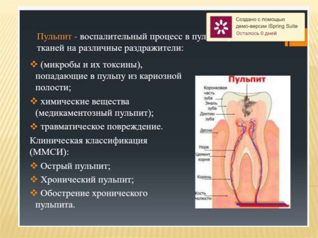 Пульпит. Клиническая характеристика - презентация онлайн