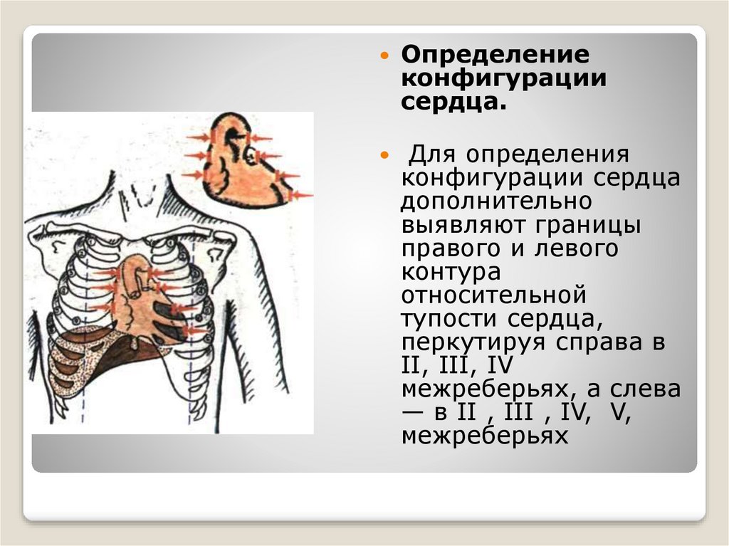 Нормальная конфигурация сердца рисунок