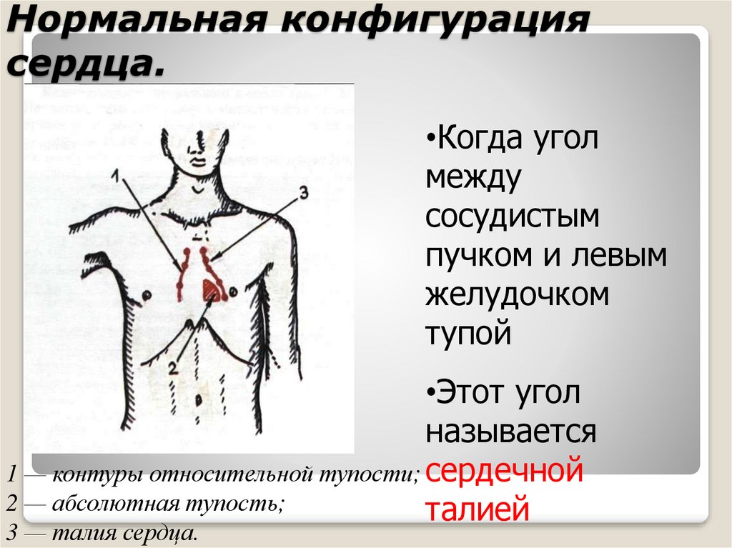 Нормальная конфигурация сердца рисунок