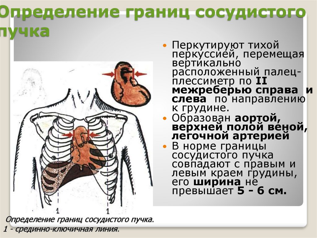 Сосудистый пучок. Перкуссия сосудистого пучка. Границы сосудистого пучка сердца.