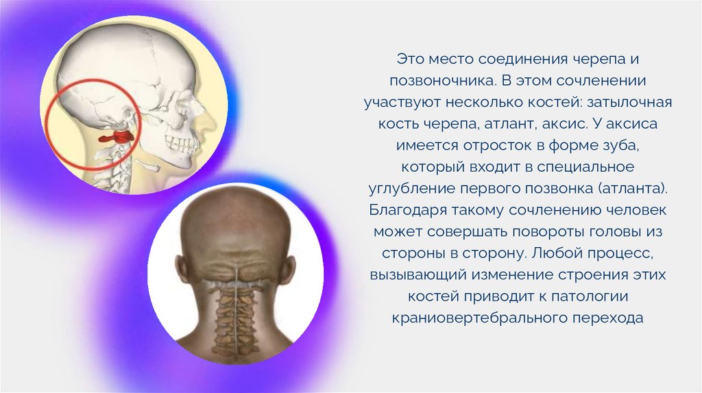 Почему болит основание черепа. Почему болит основание черепа
