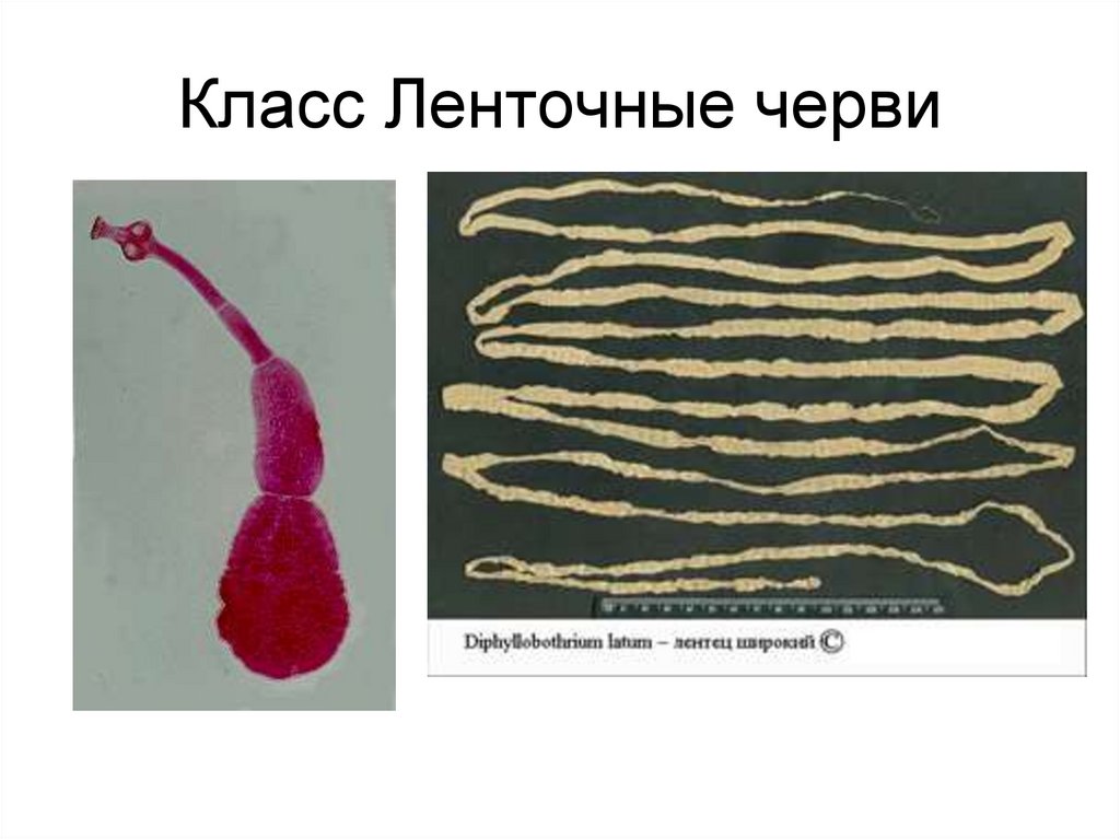 Жизнь ленточного червя. Тип плоские черви класс ленточные. Тип плоские черви класс ленточные черви строение. Класс ленточные черви (Cestoda). Представители класса ленточные.