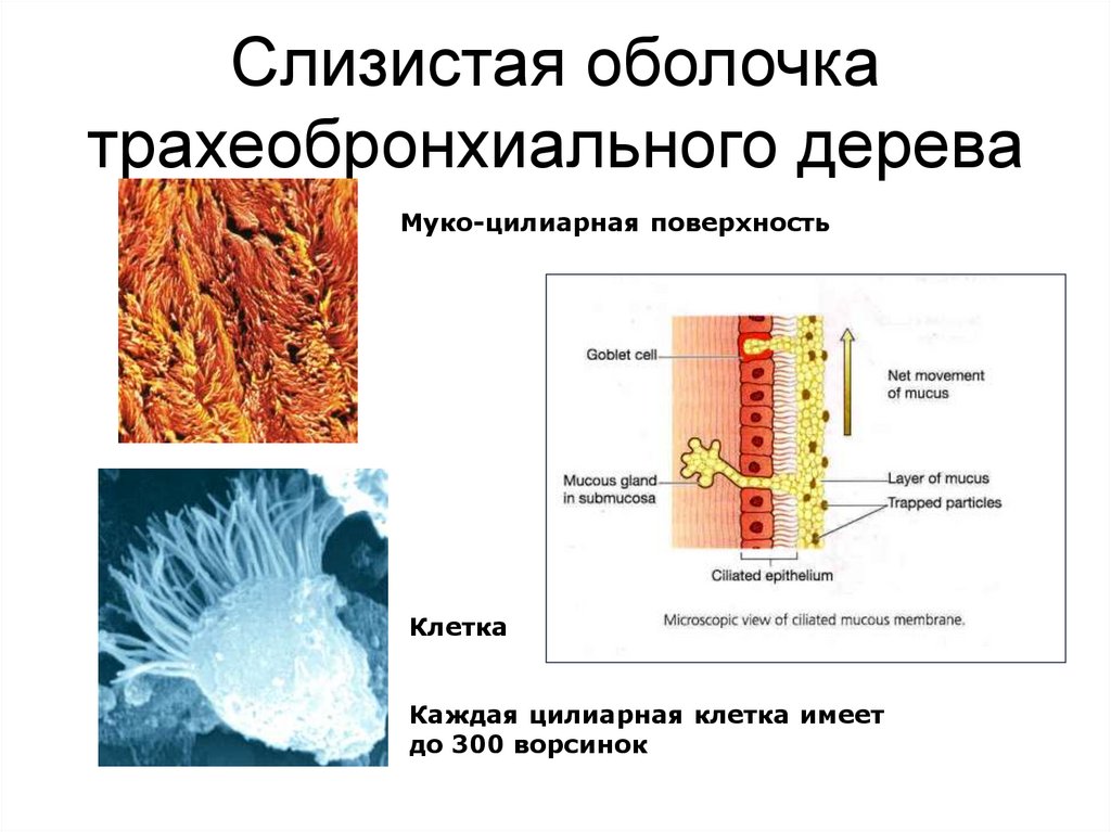 Слизистая оболочка трахеобронхиального дерева