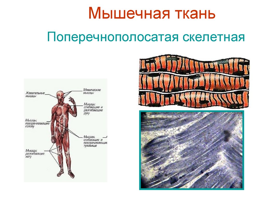 Изображение поперечно полосатой мышечной ткани. Скелетные поперечнополосатые мышечные ткани. Поперечно полосатая Скелетная ткань. Поперечно полосатая мускулатура. Поперечно полосатая Скелетная мускулатура.