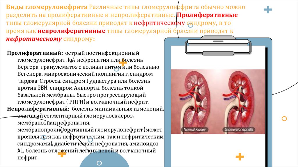 Гломерулонефрит у кошек