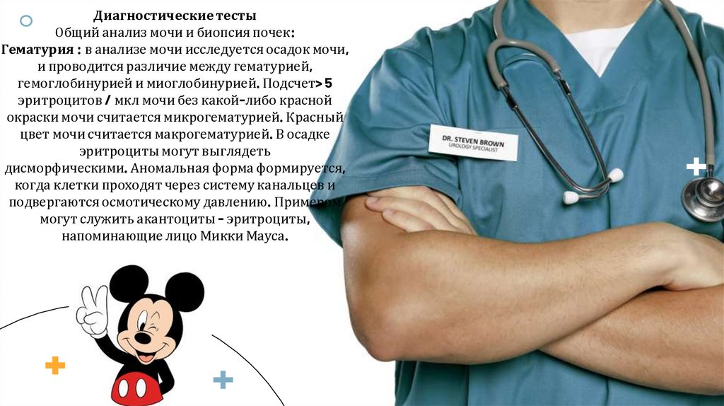 Диагностические тесты Общий анализ мочи и биопсия почек: Гематурия : в анализе мочи исследуется осадок мочи, и проводится