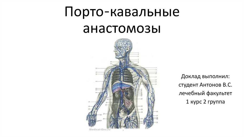 Порто кавальные и кава кавальные анастомозы