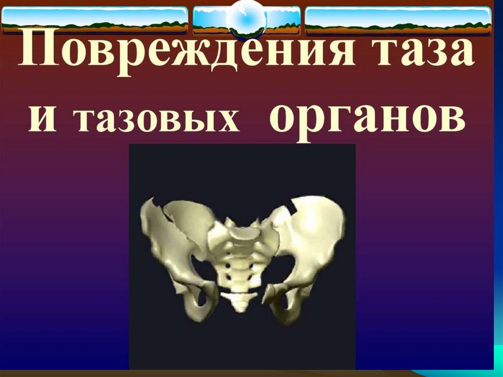 Травма таза. Повреждение таза и тазовых органов. Переломы костей таза с повреждением тазовых органов. Классификация повреждений таза и тазовых органов. Повреждение тазовых органов при переломах таза.