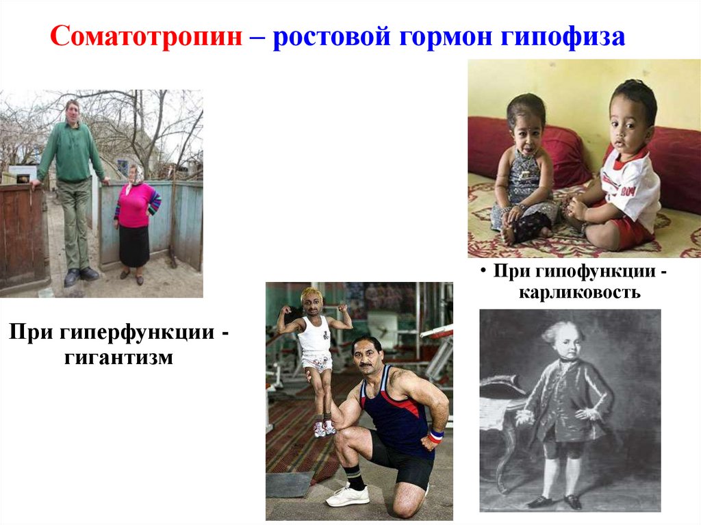 Гормоны гипо и гиперфункция. Соматотропин гиперфункция и гипофункция. Гиперфункция сетчатой зоны. Кортикотропин гипо и гиперфункции.