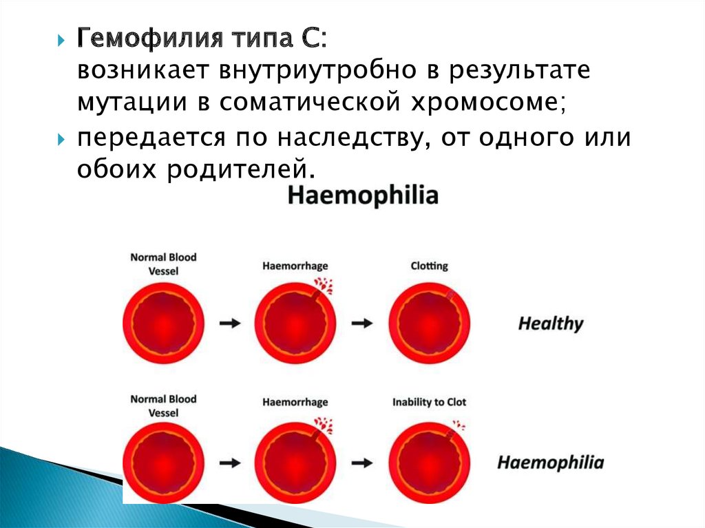 Гемофилия метод