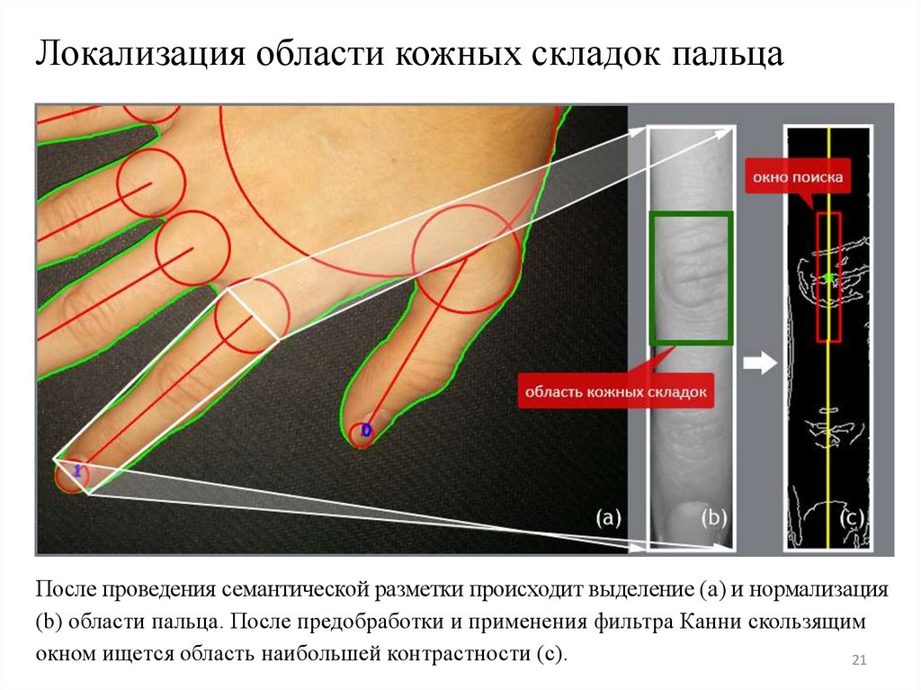 Локализация области кожных складок пальца