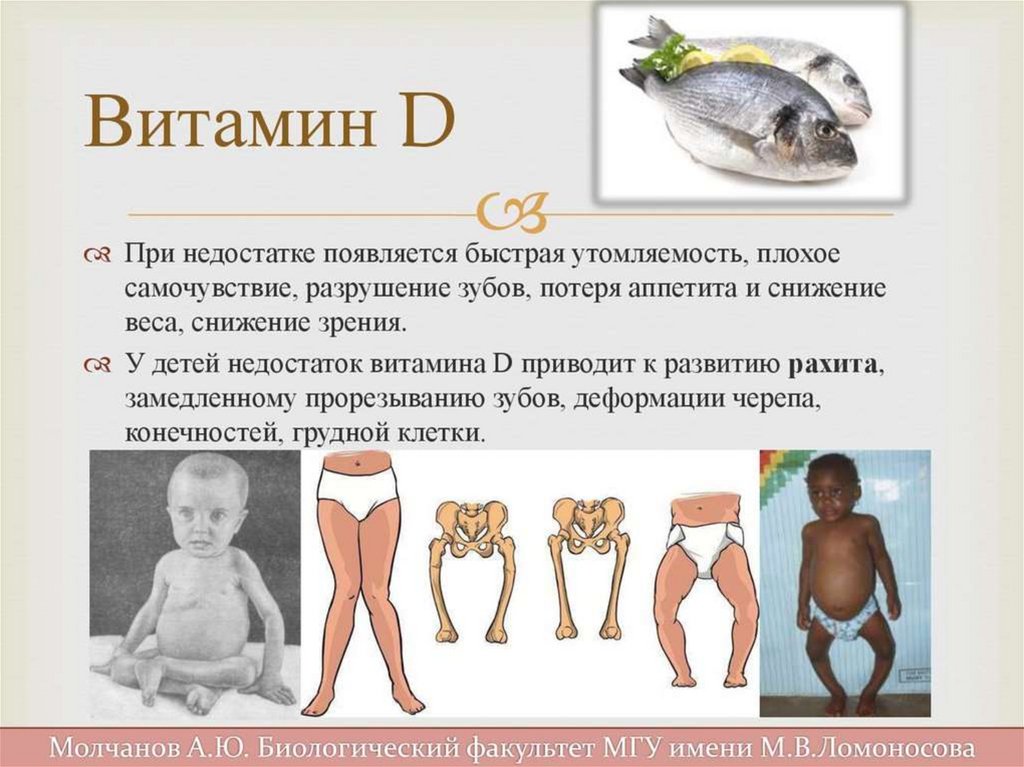 Рахит картинки для презентации