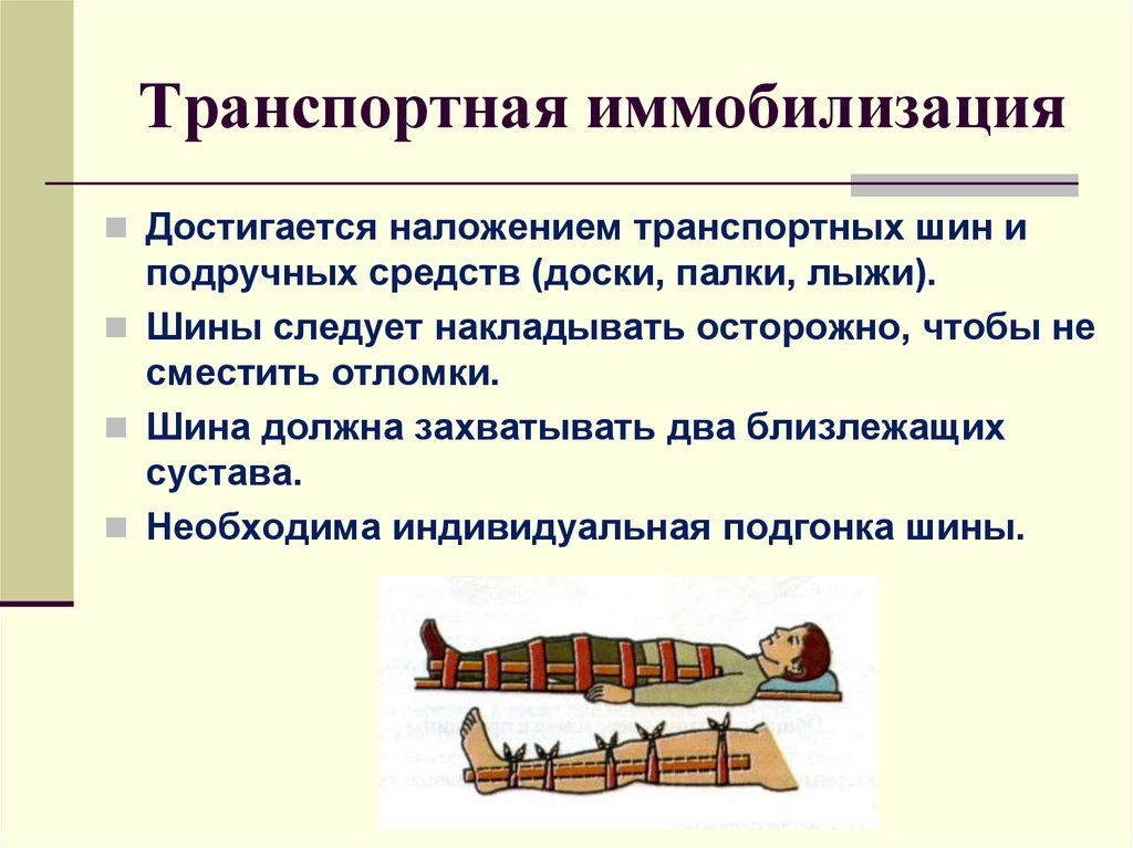 Типы иммобилизации. Транспортная иммобилизация стандартными шинами. Алгоритм проведения транспортной иммобилизации конечностей. Правило наложение транспортных шин. Транспортная иммобилизация при переломах костей.