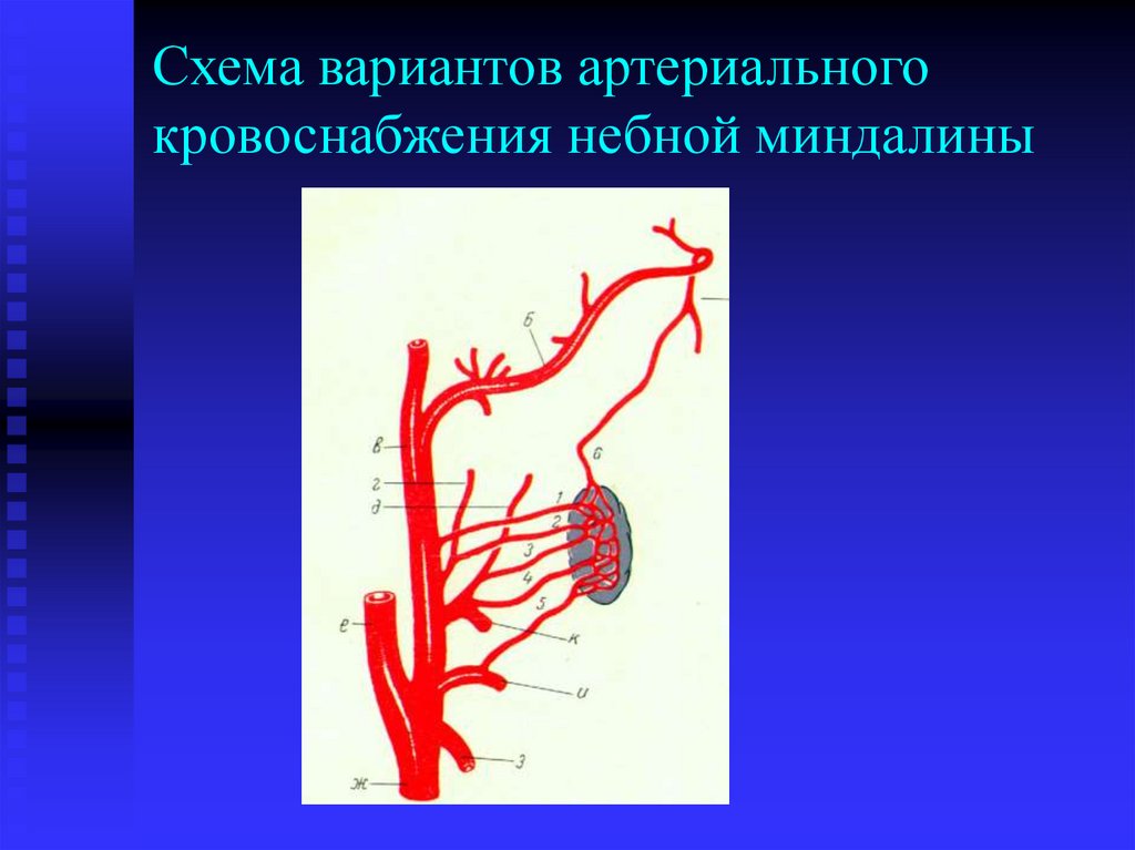 Схема вариантов артериального кровоснабжения небной миндалины