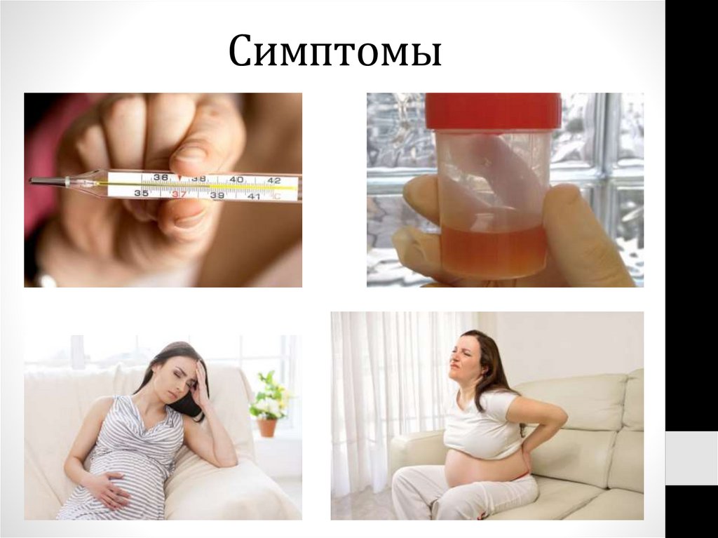 Симптомы