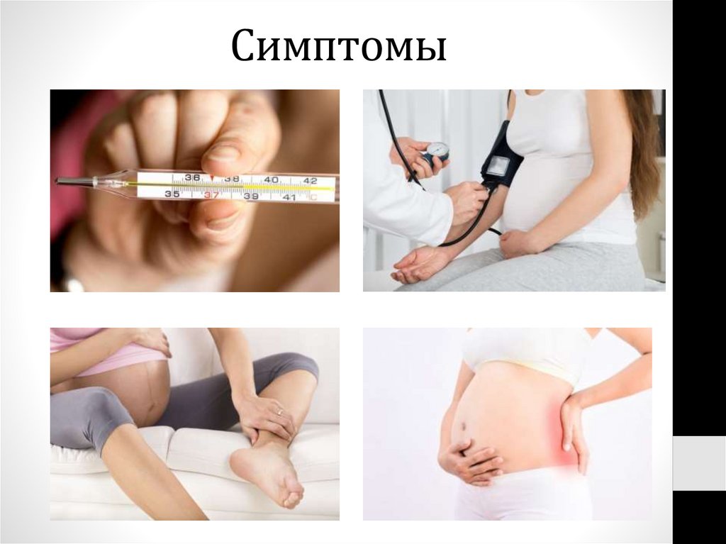 Симптомы