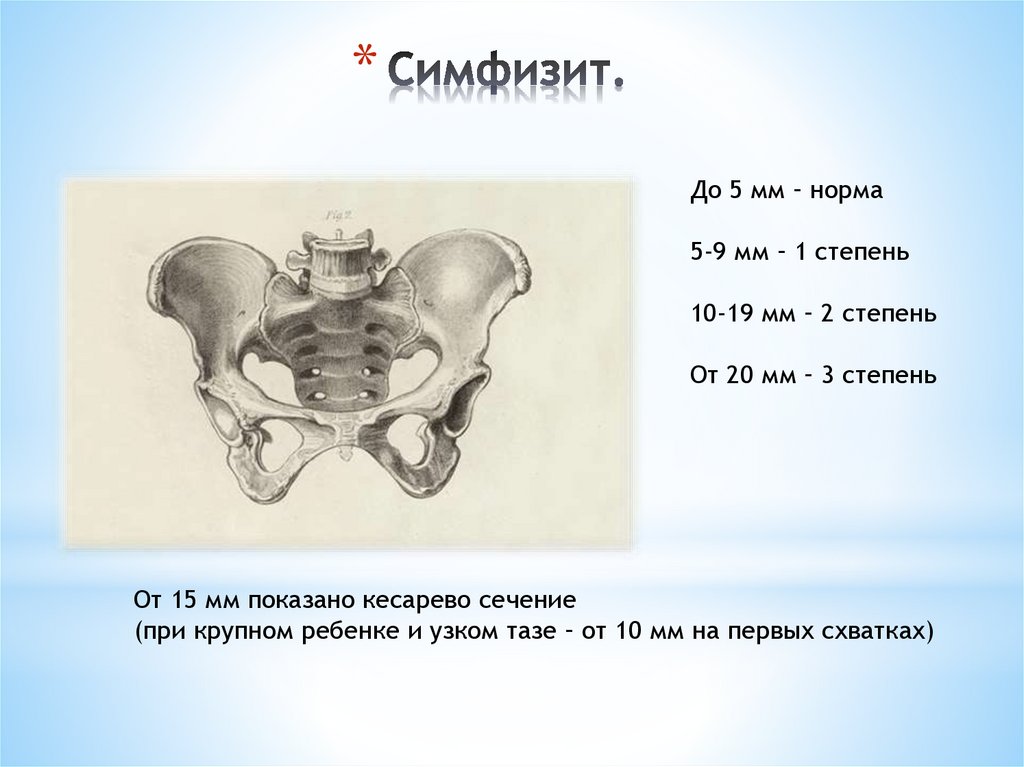 Род крупно