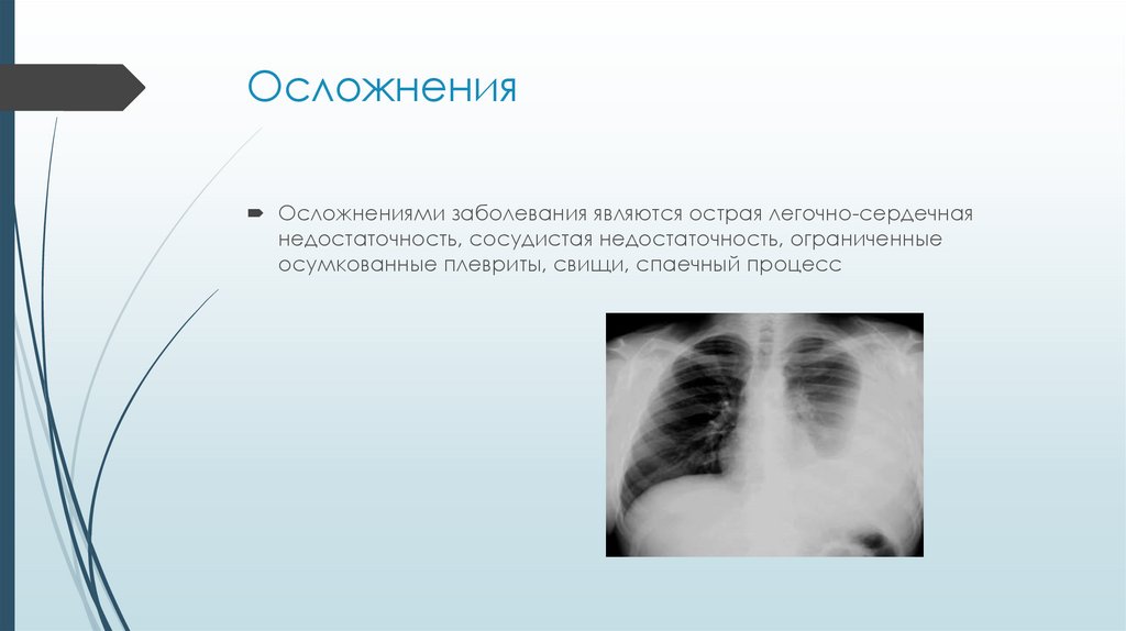 Плеврит - презентация онлайн