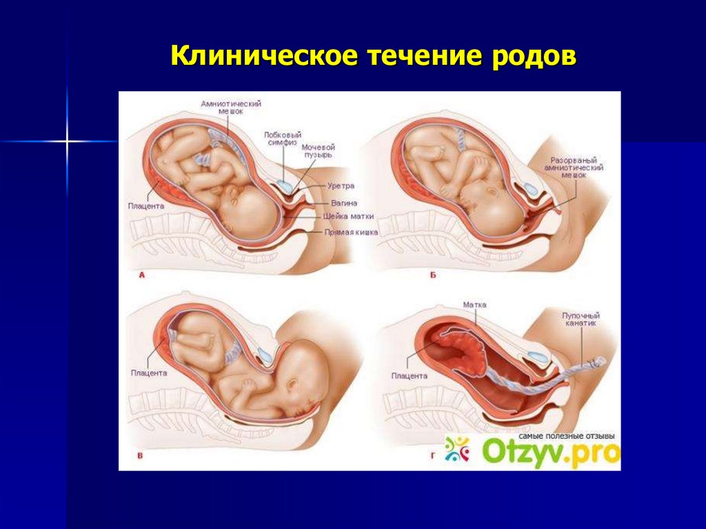 Периоды родов презентация