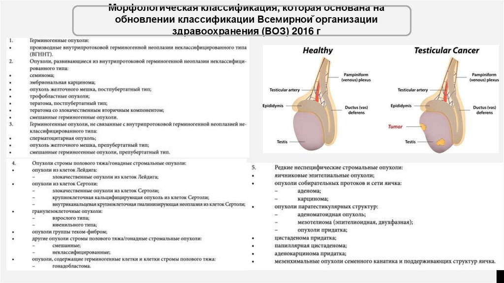 Рак яичка - презентация онлайн